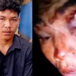 Keluarga Soroti Lambatnya Kasus Pengeroyokan Bekasi